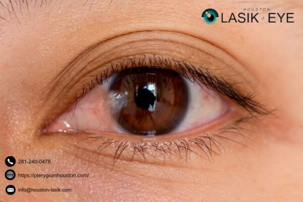 Surgery For Pterygium | Pterygiumhouston.com