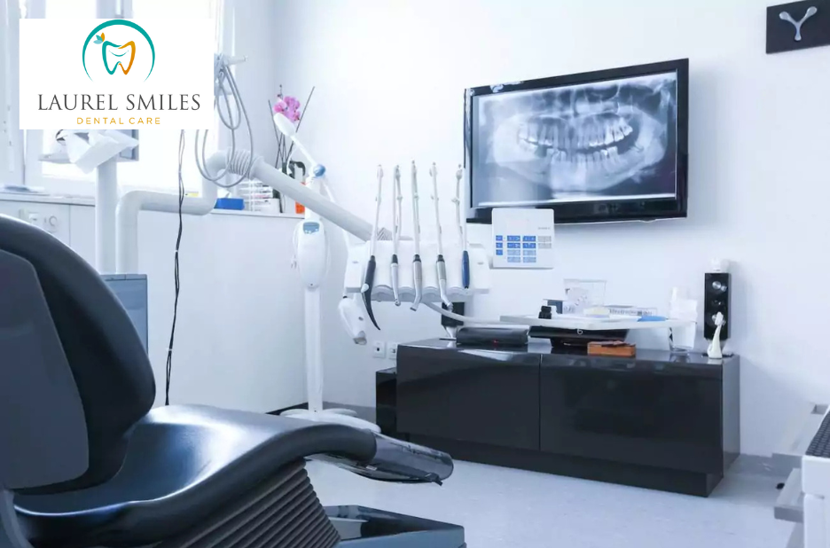 Smile Makeover in Laurel: Transform Your Teeth with Porcelain Veneers