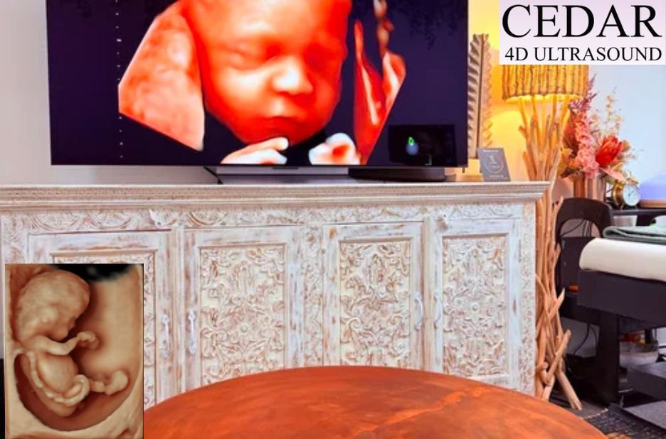 Discover Live Baby Moments in Perth: 4D Ultrasound Specials