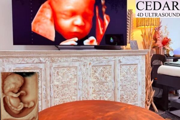 Schedule Your Baby Scan in Perth — Fast, Easy Booking