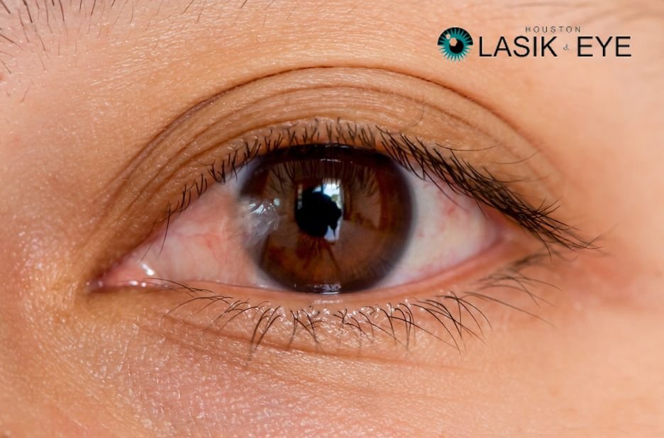 What to Expect After Pterygium Surgery: A Practical Guide