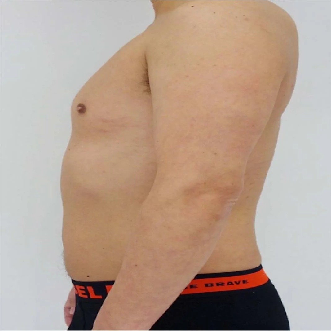 Managing Duromine: Understanding Potential Reactions and Safety