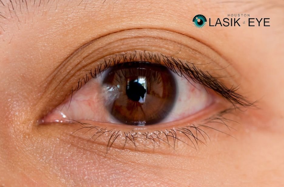 Natural ways to ease discomfort from a pterygium