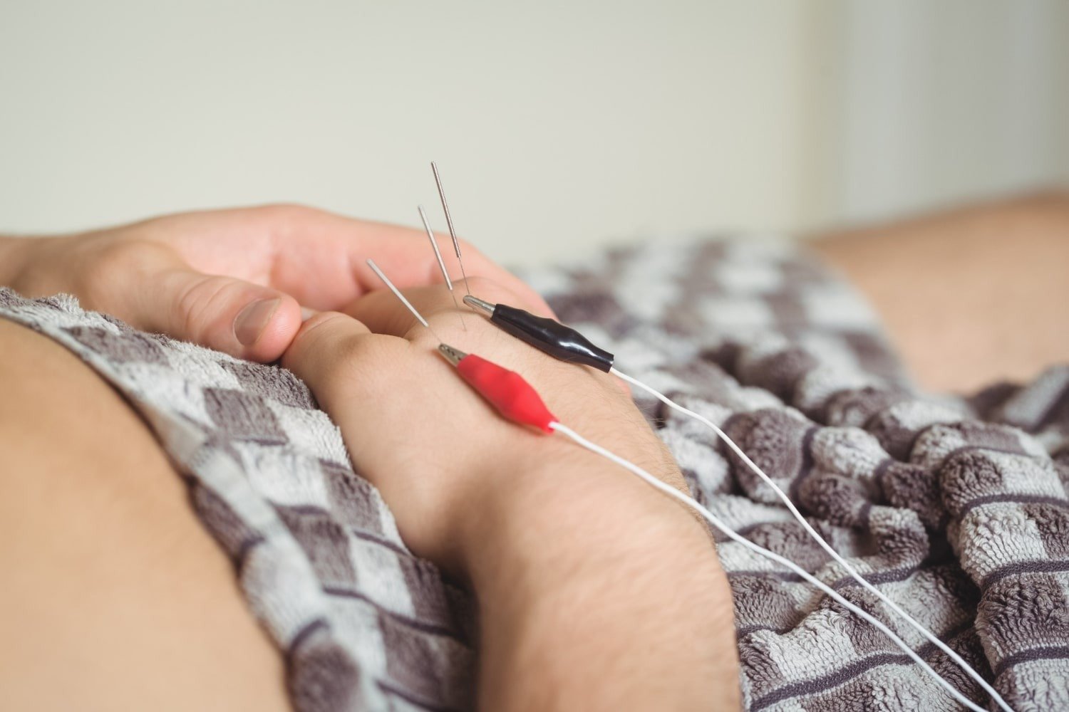Camrose Physio for Motor Vehicle Injuries: Expert Rehabilitation