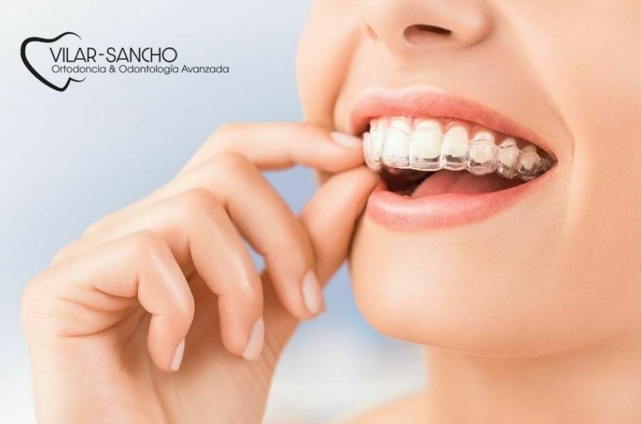 Cuidado dental en Pozuelo: prevención y salud bucal