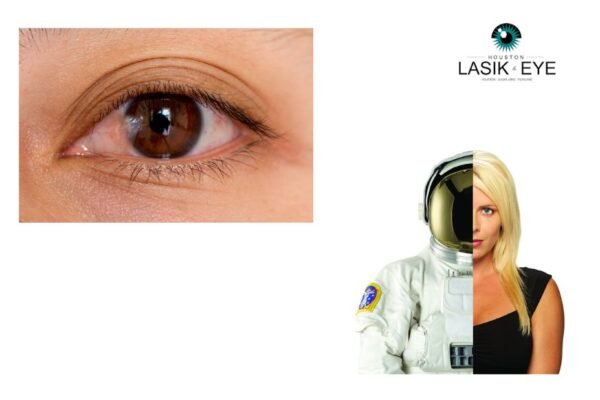 How to Alleviate Pterygium Symptoms and Seek Care
