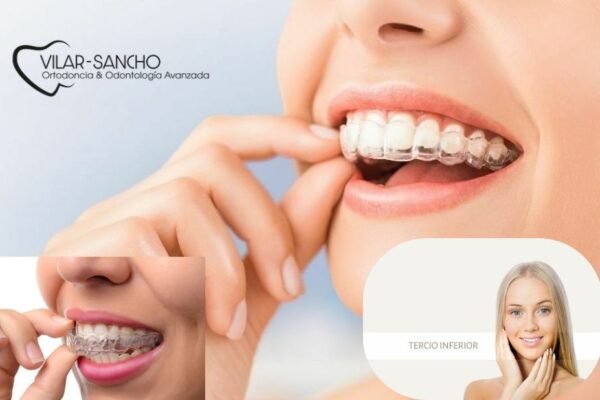 Tu sonrisa perfecta en Pozuelo de Alarcón: dentistas de confianza