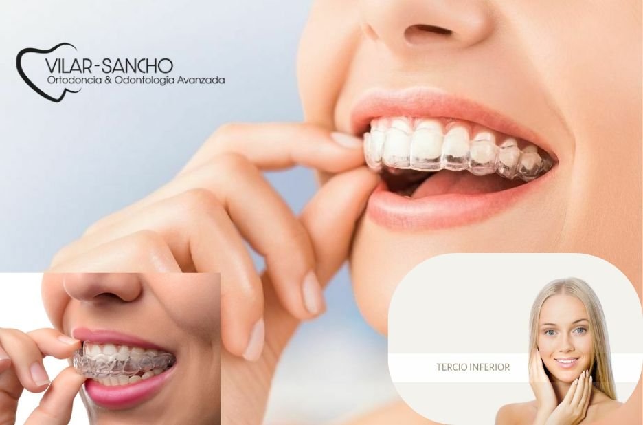Tu sonrisa perfecta en Pozuelo de Alarcón: dentistas de confianza