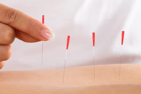 Relieve Neck Pain with Expert Chiropractors in Royal Oak