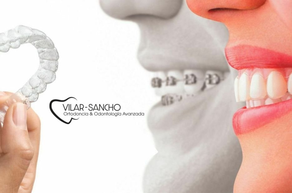 Sonrisa perfecta en Pozuelo: ortodoncia de confianza