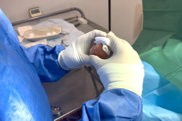 Relieve Toe Pain: Expert Care for Affected Nails