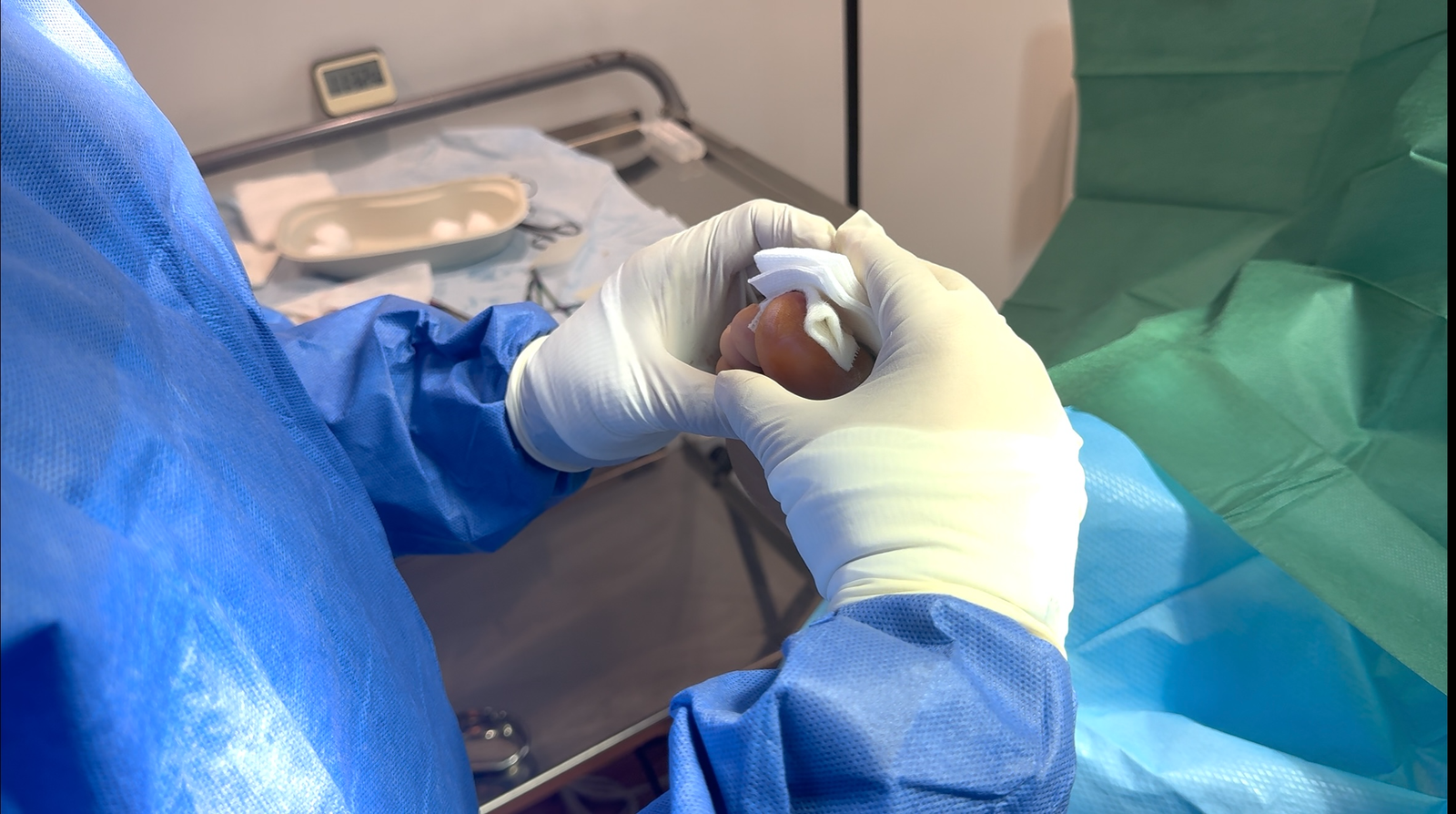 Relieve Toe Pain: Expert Care for Affected Nails