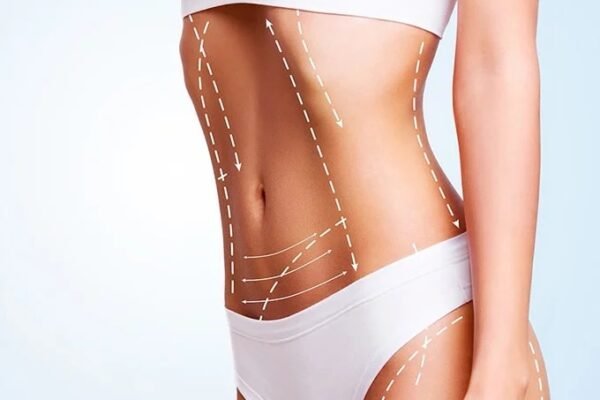 Elevate Your Confidence with a Breast Lift in Melbourne