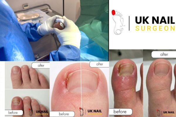 GentleCare for Little Toes: Nail Health for Children
