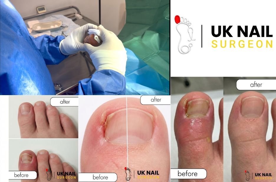 GentleCare for Little Toes: Nail Health for Children
