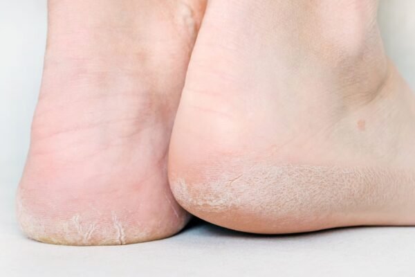 Supportive, Comfortable Foot and Ankle Bracing for Everyday Wear