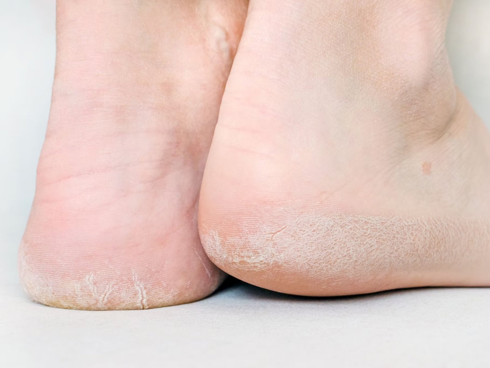 Supportive, Comfortable Foot and Ankle Bracing for Everyday Wear