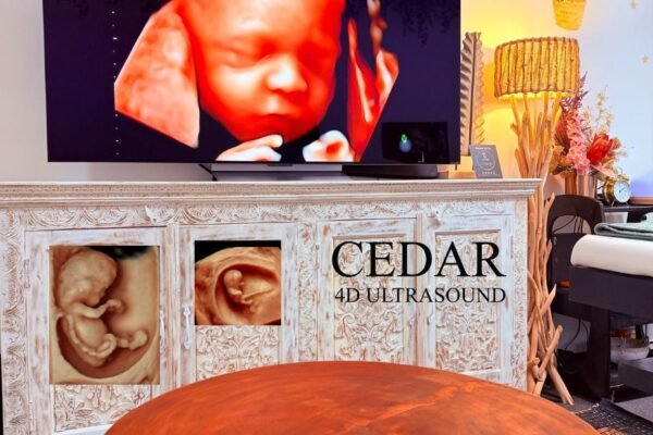 Discover Clear Baby Images in Perth with 3D/4D Ultrasound
