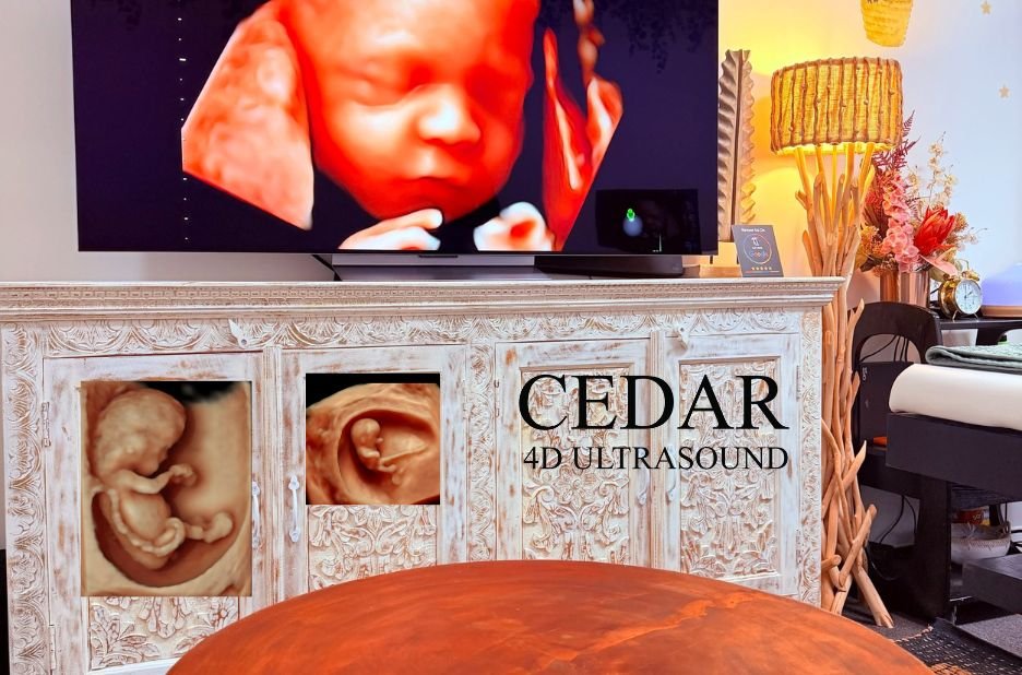 Discover Clear Baby Images in Perth with 3D/4D Ultrasound