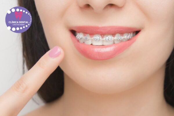 Sorrís amb confiança: implants dentals a Gines