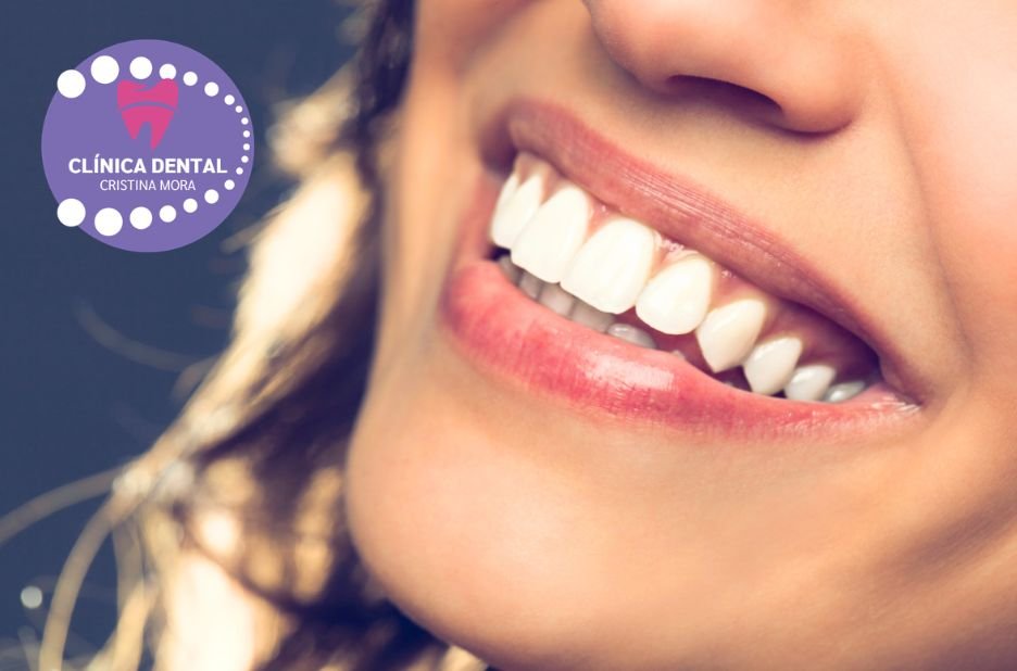 Implants dentals a Gines: somriure estable i natural
