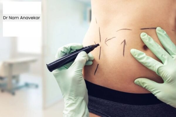 Top Australian Breast Augmentation Surgeon for Natural Results