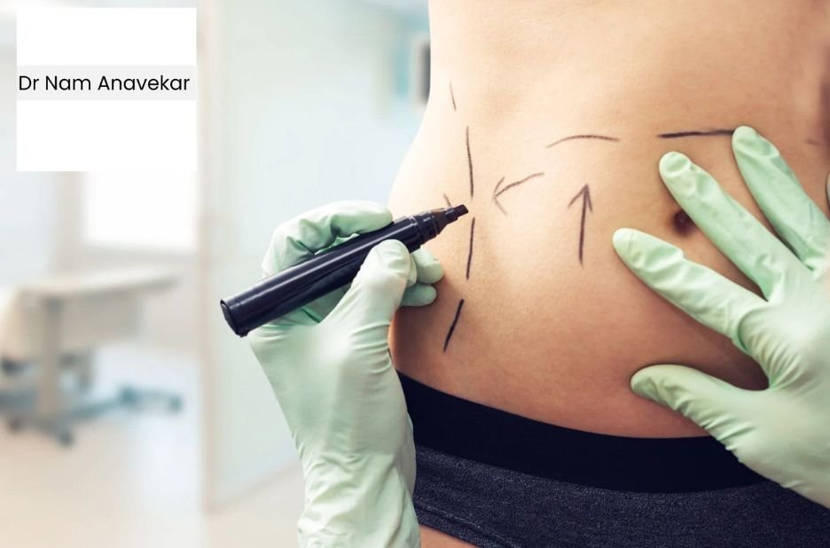 Top Australian Breast Augmentation Surgeon for Natural Results