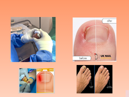 Caring Solutions for Young Toes: Gentle Nail Care for Children