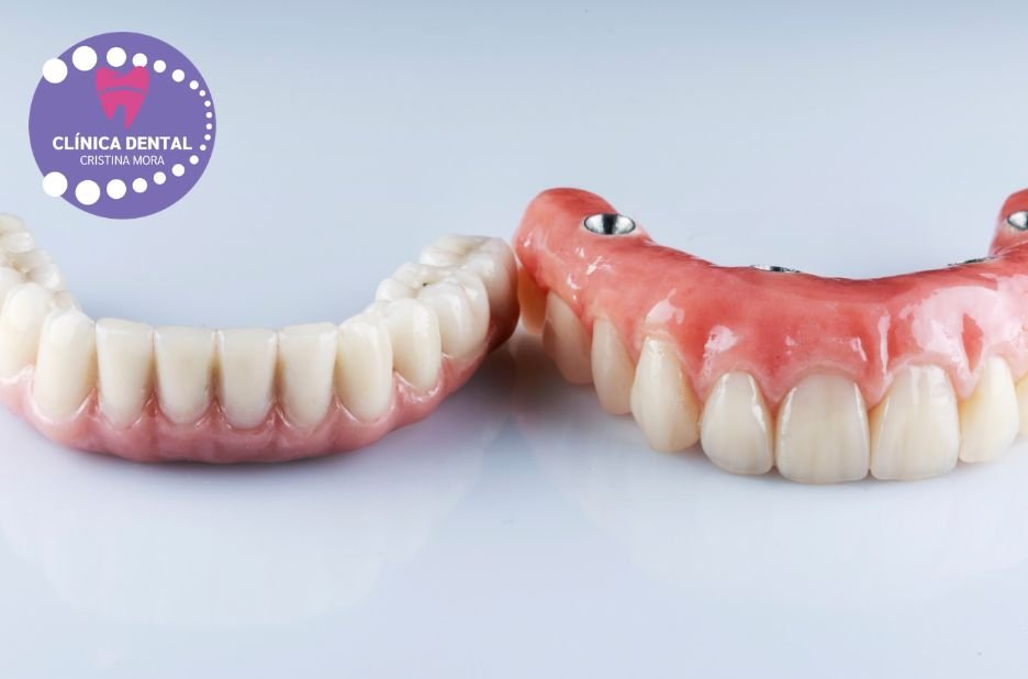 Pròtesis Dental a Gines: solucions duradores i naturals