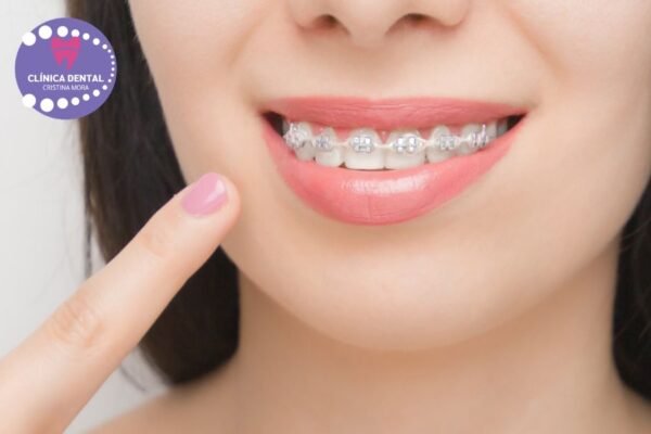 Somriure més brillant a Gines: blanqueament dental eficaç