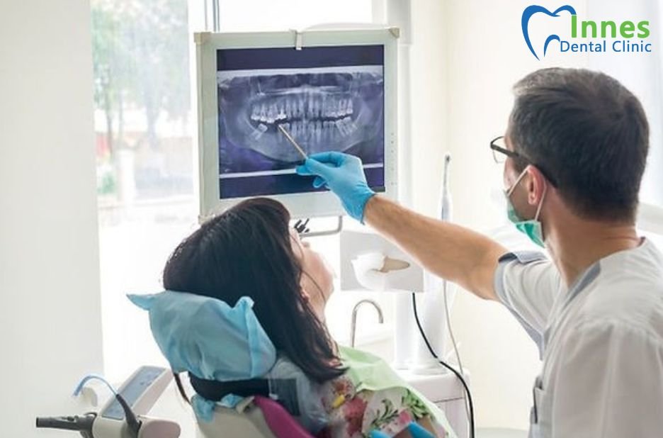 Restore Your Smile with Expert Tooth Crowns in Your Area