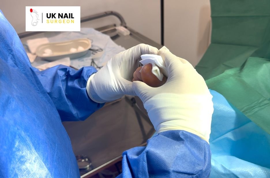Expert Toenail Care in Birmingham: Safe, Local Treatments