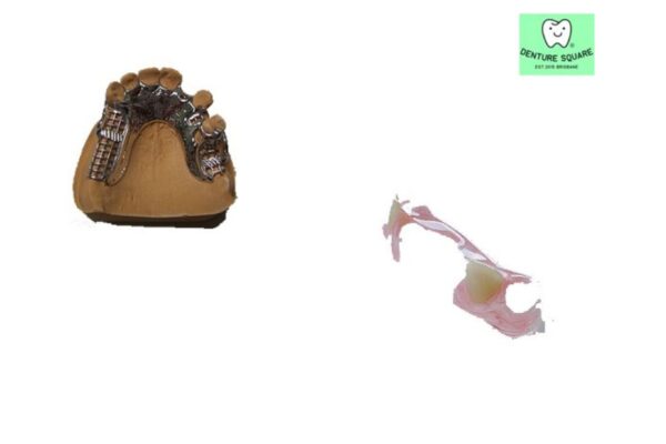 Affordable dentures that don’t break the bank for a confident smile