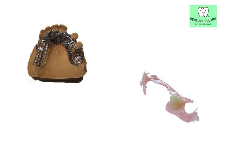 Affordable dentures that don’t break the bank for a confident smile
