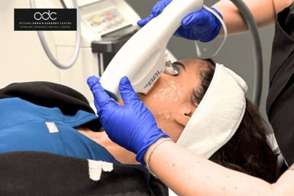 Find Trusted Botox Clinics Nearby for Natural-Looking Results