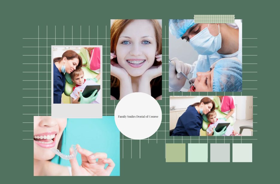 Affordable Dental Bonding in Conroe – Transform Your Smile Today