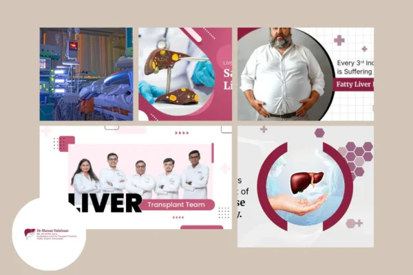 Top Liver Specialist Doctor in Ahmedabad for Advanced Hepatology Care and Liver Treatment