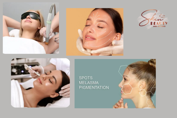 Find The Best Microneedling In Oakville| Skinbeautyandbeyond.com