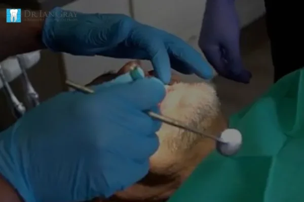 Sedation Options for Anxious Patients Newmarket | Safe & Effective Dental Care