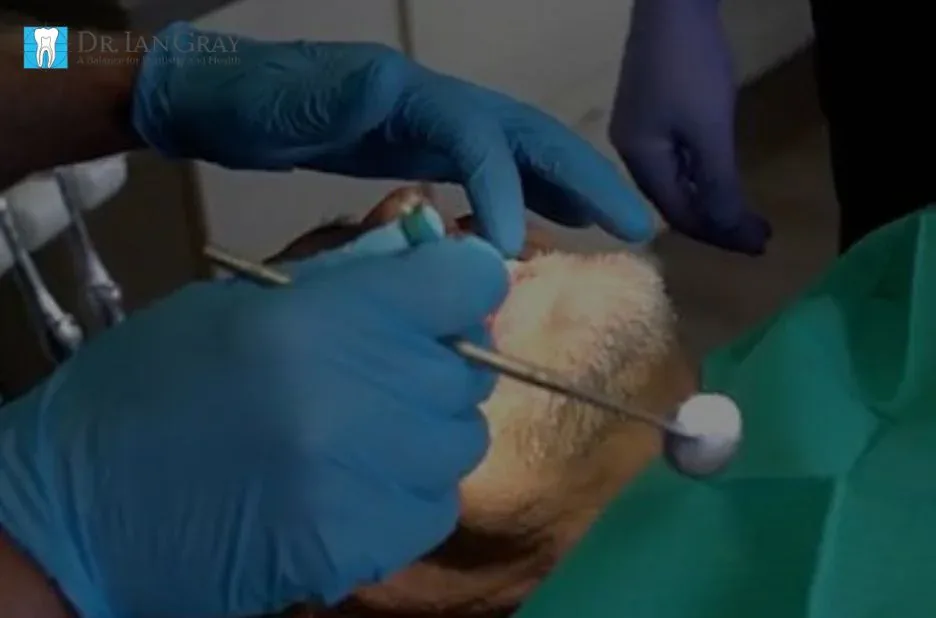 Sedation Options for Anxious Patients Newmarket | Safe & Effective Dental Care