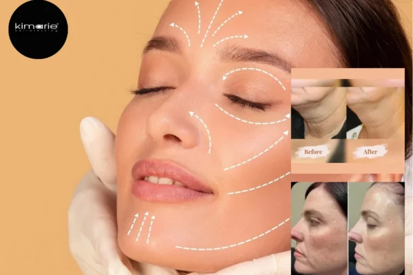Affordable Microdermabrasion in Oakville | Skinbeautyandbeyond.com Best Skin Care Solutions