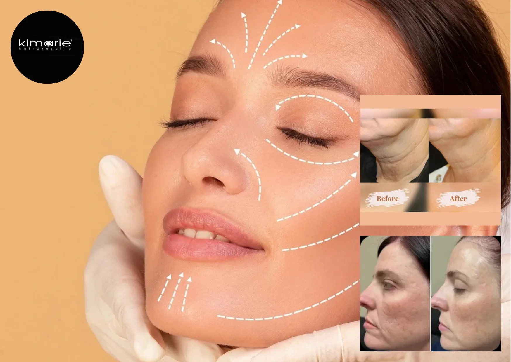 Affordable Microdermabrasion in Oakville | Skinbeautyandbeyond.com Best Skin Care Solutions