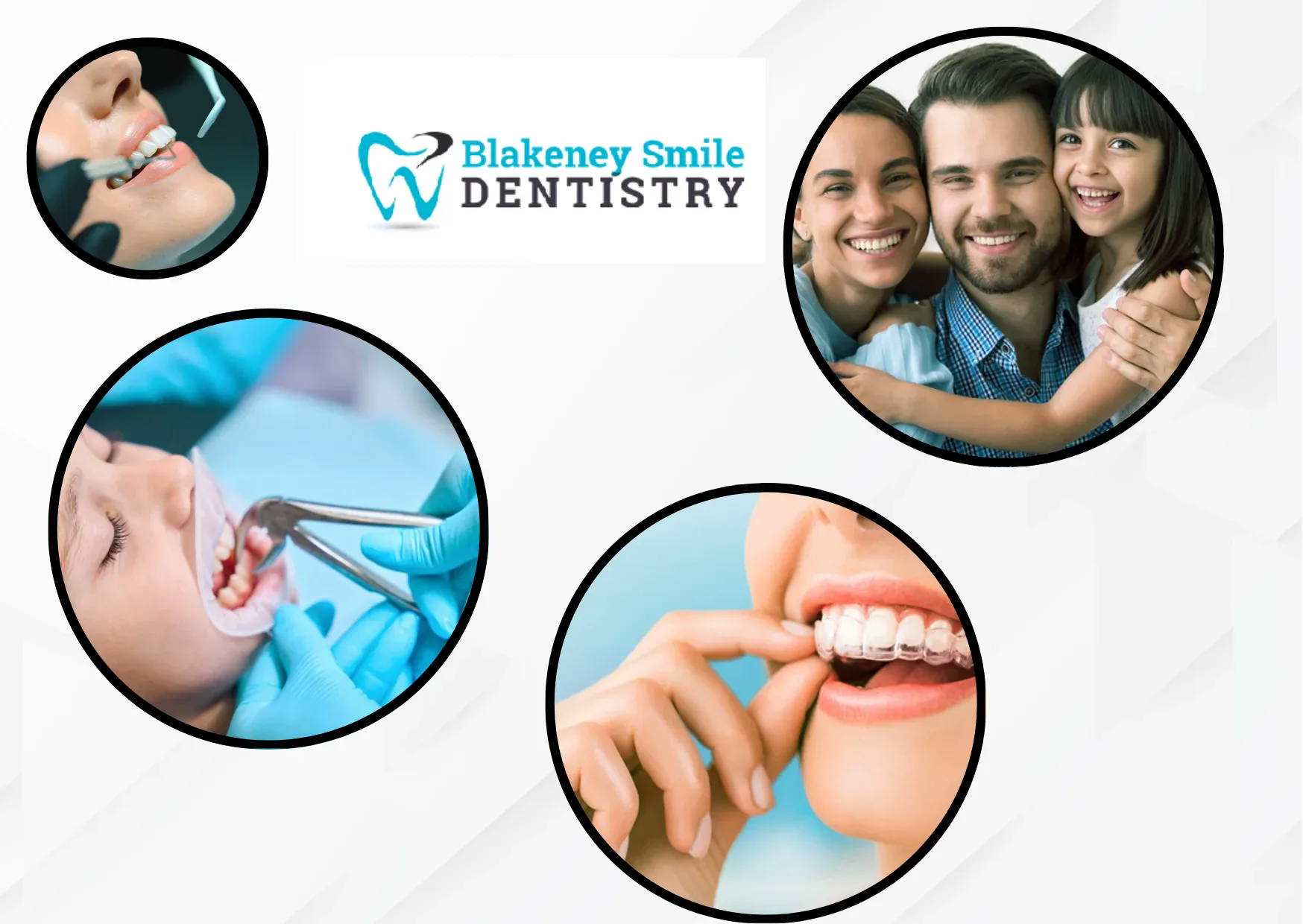 Top-Rated Dental Implants in Indian Land SC | Blakeney Smile Dentistry