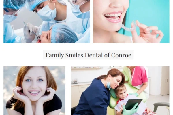 Affordable Dental Bonding in Conroe for a Beautiful Smile Transformation