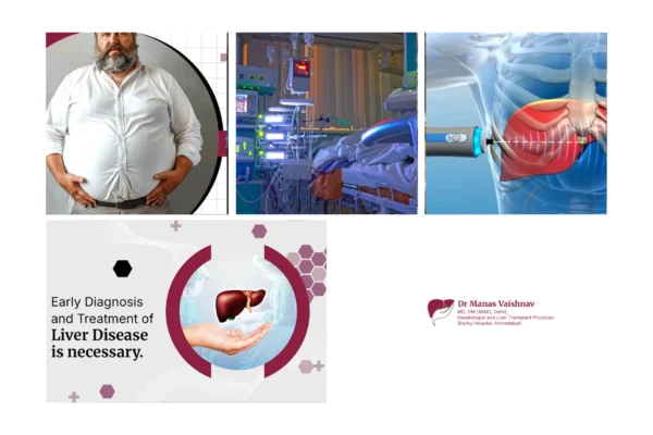Best Liver Doctor in Ahmedabad for Expert Hepatology and Liver Disease Care