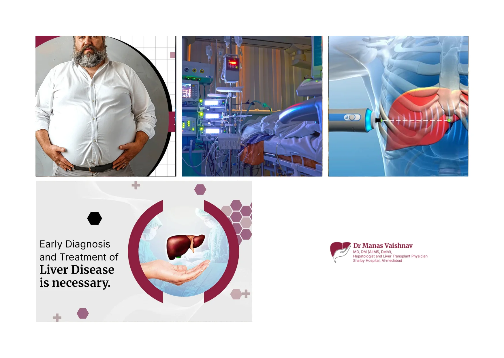 Best Liver Doctor in Ahmedabad for Expert Hepatology and Liver Disease Care