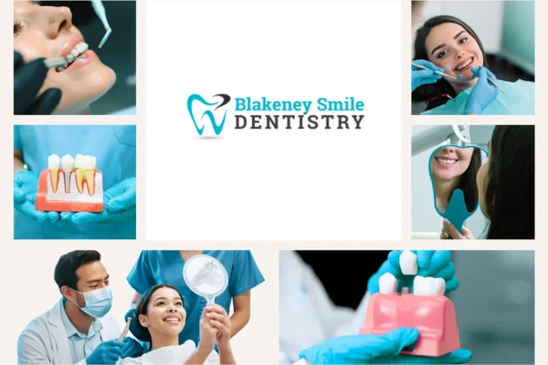 Professional Teeth Whitening Charlotte NC for a Brighter Smile
