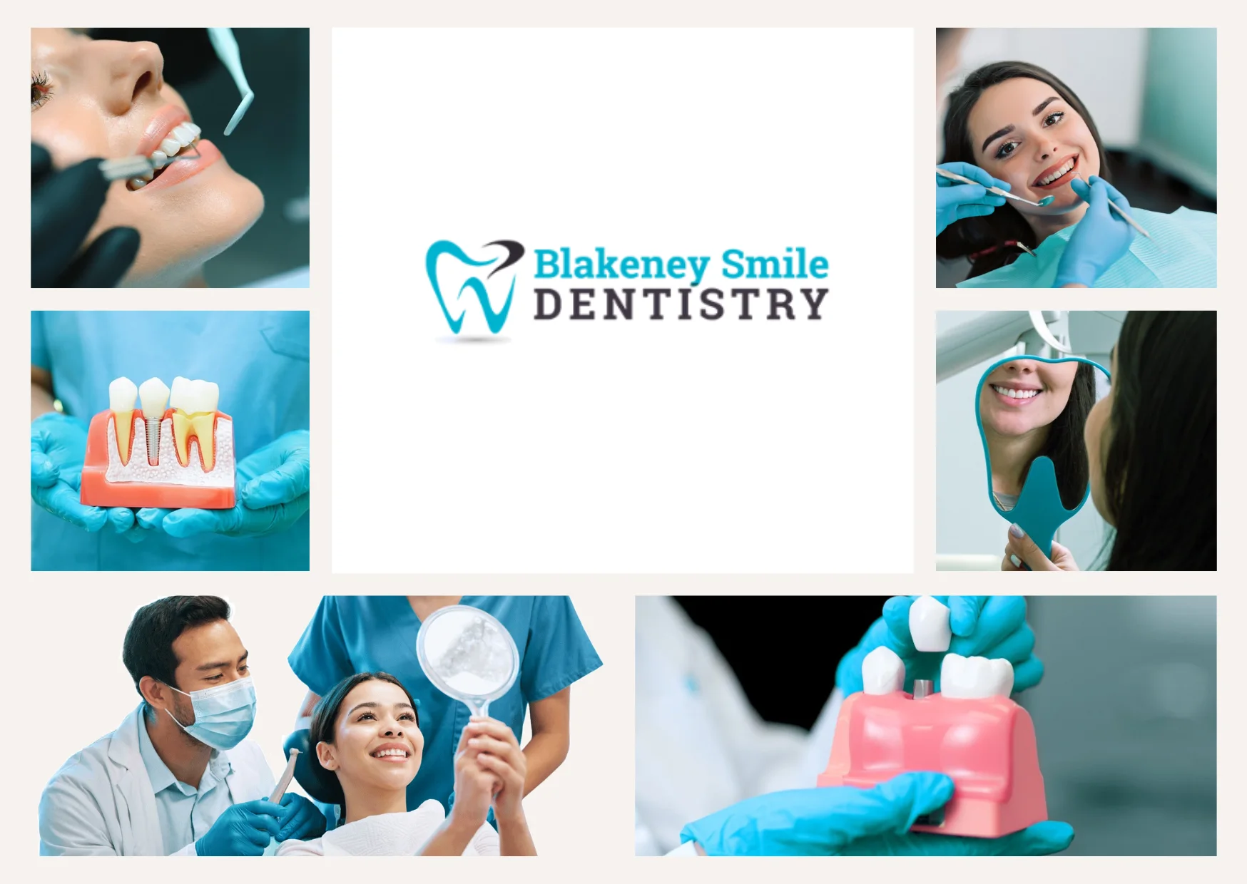 Professional Teeth Whitening Charlotte NC for a Brighter Smile