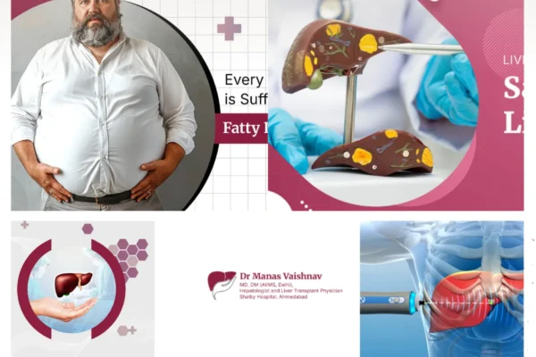 Top Best Gastroenterologist Ahmedabad for Advanced Liver and GI Care