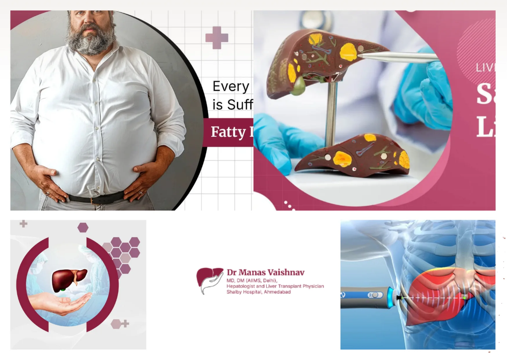 Top Best Gastroenterologist Ahmedabad for Advanced Liver and GI Care